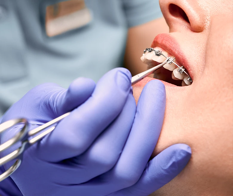 Common Orthodontic Issues We Treat ​
