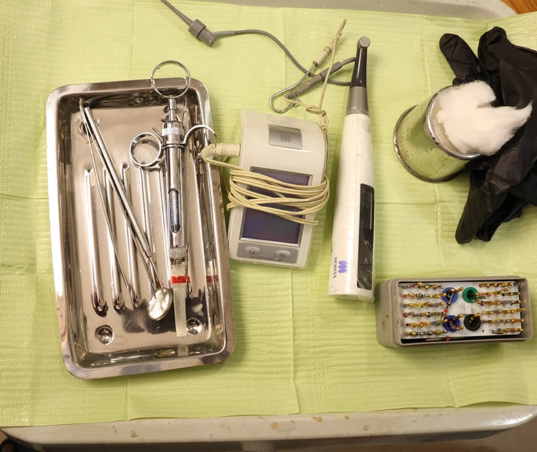 Signs that You Might Need Root Canal Treatment