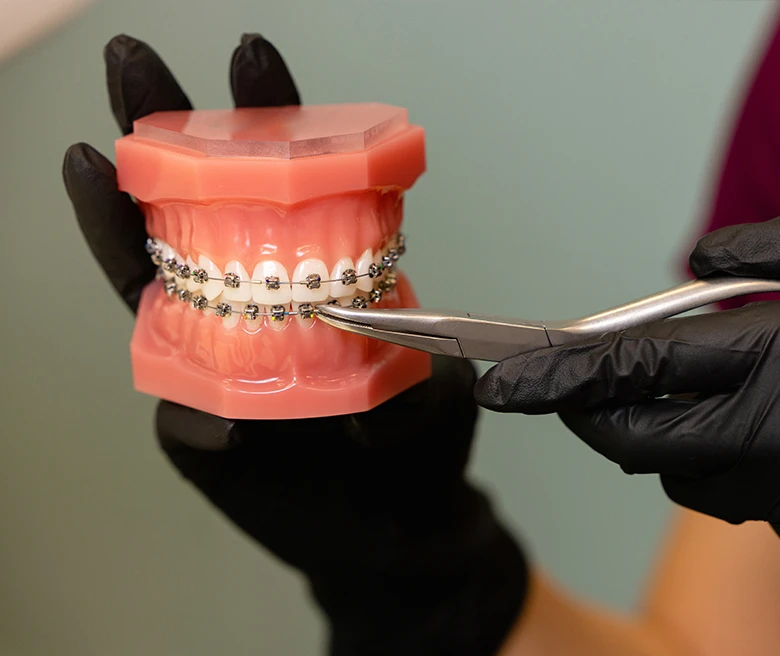 What Are Orthodontic